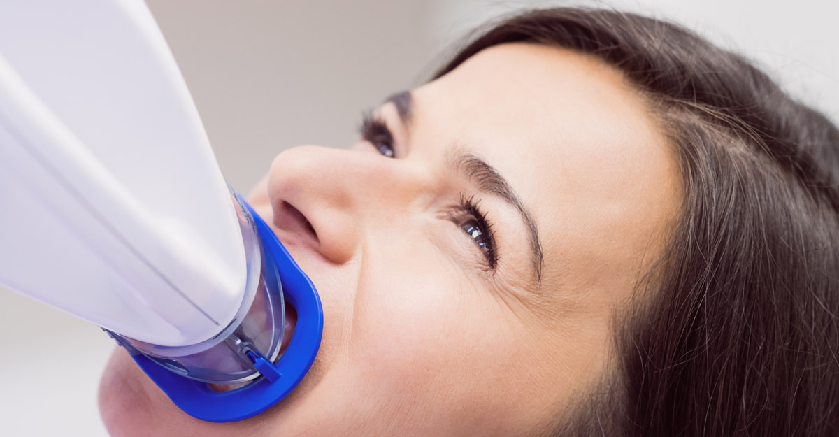 Izbeljivanje - Dental M Plus